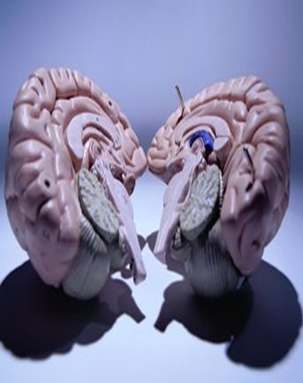 Corpus Callosum